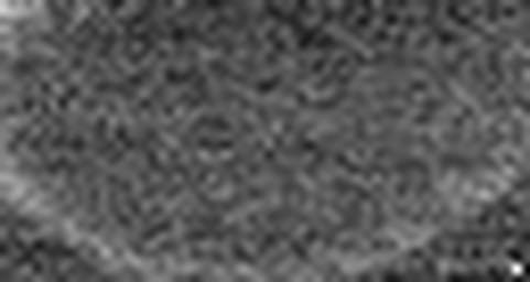 1616845963_1 @ 5 µm