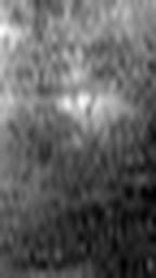 1857756462_1 @ 5 µm