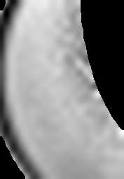 1796989146_1 @ 1.59/1.26 µm